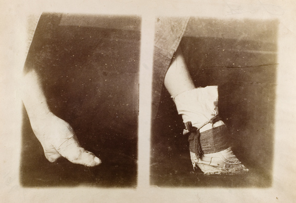 Foot binding