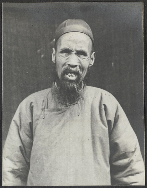 Kung Men Chen, Kansu. Teeth.
