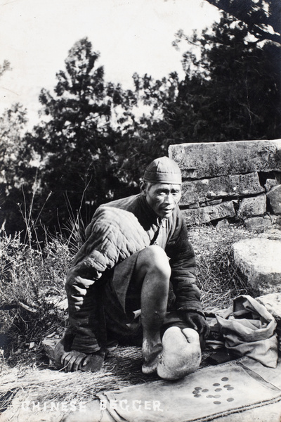 Beggar with malformed or swollen foot, and coins