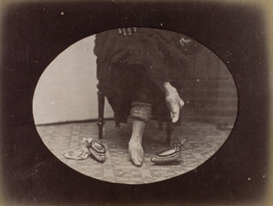 A woman with bound feet, sitting, with her shoes nearby