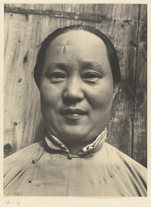 Woman with a scar on her forehead